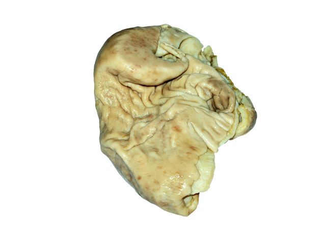 Abomasum