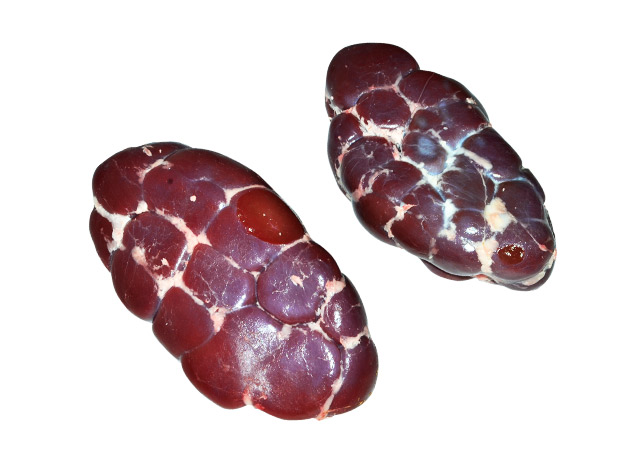 Kidney