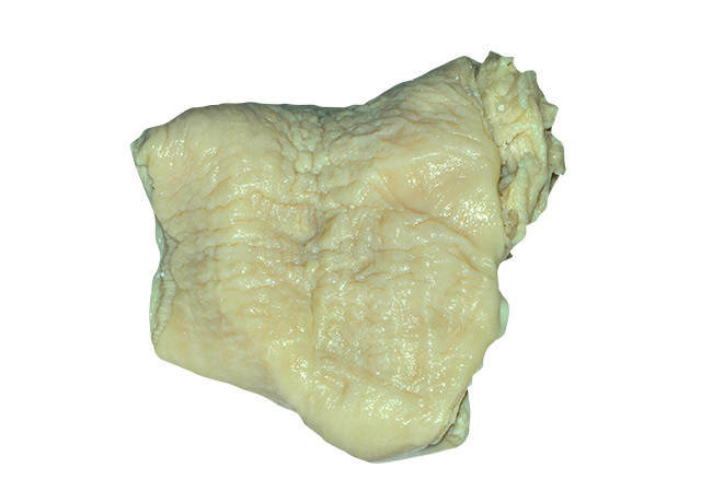 Rectum